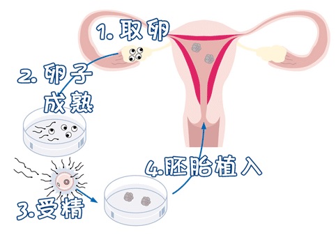 靠谱试管代孕机构